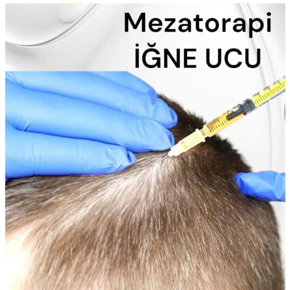 BD Microlance Sarı Mezoterapi İğne Ucu 30G 13mm (10’lu Paket)